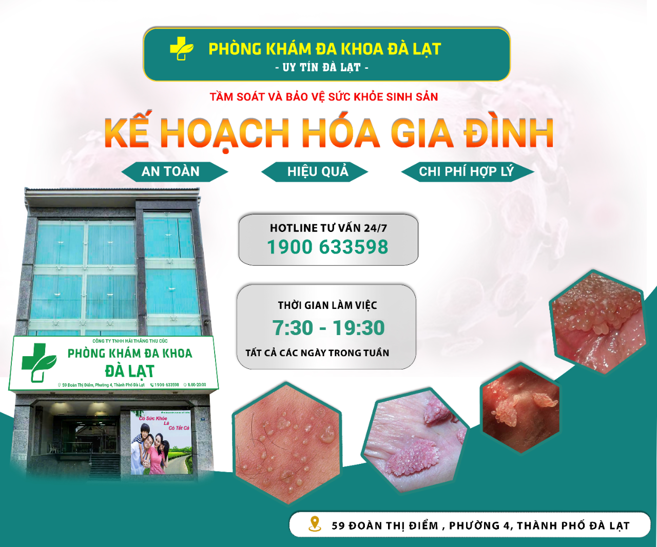 Hình ảnh minh họa